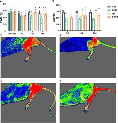 Effect of 10.6 μm laser moxibustion on inflammation in diabetic peripheral neuropathy rats